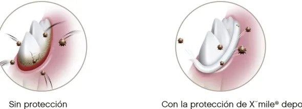 XMILE DEPOT gel adhesivo 20 g gingivitis perros gatos
